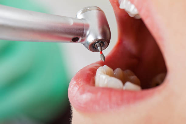 Best Urgent Tooth Repair  in Merian, ID